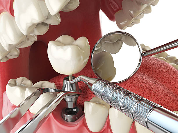 Professional Emergency Dental Service in IN